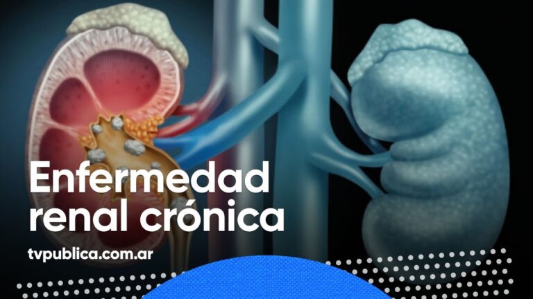 Inicio
